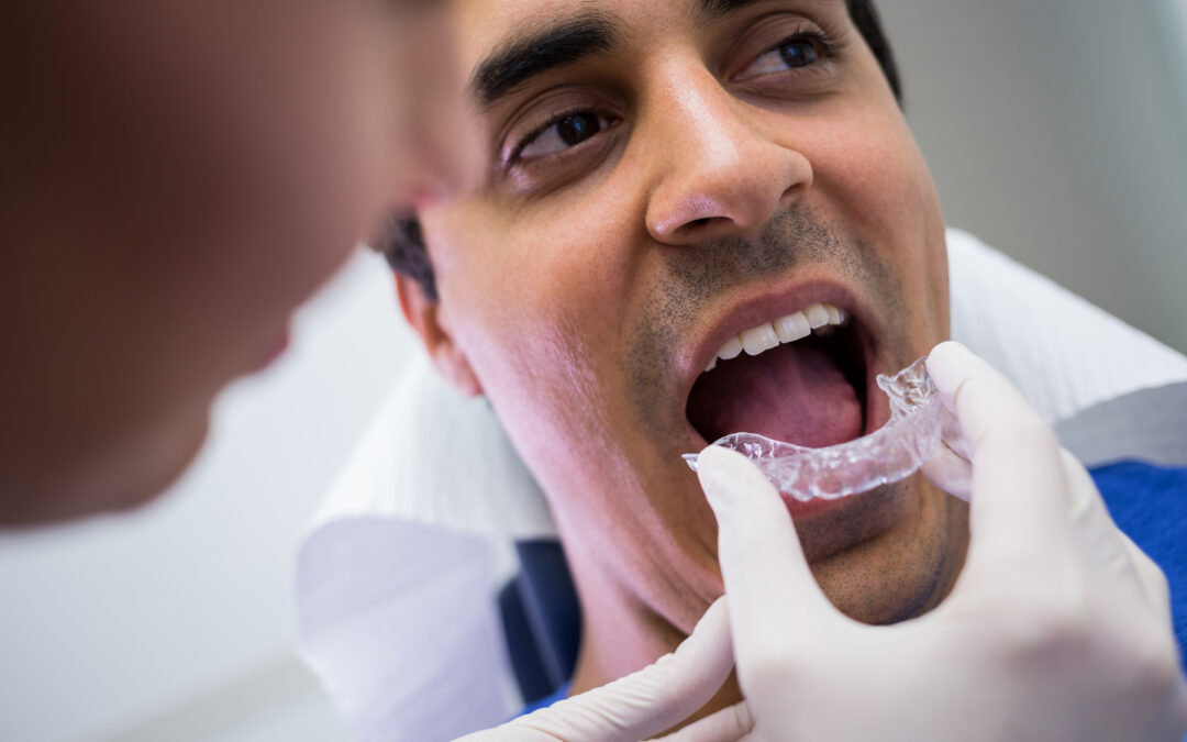 Braces vs Aligners vs Invisalign